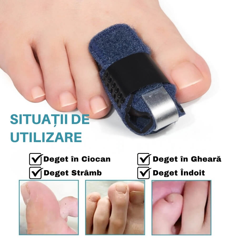 Set 2 buc. Corector Ortopedic pentru Deget în Ciocan – Confort și Susținere la Fiecare Pas
